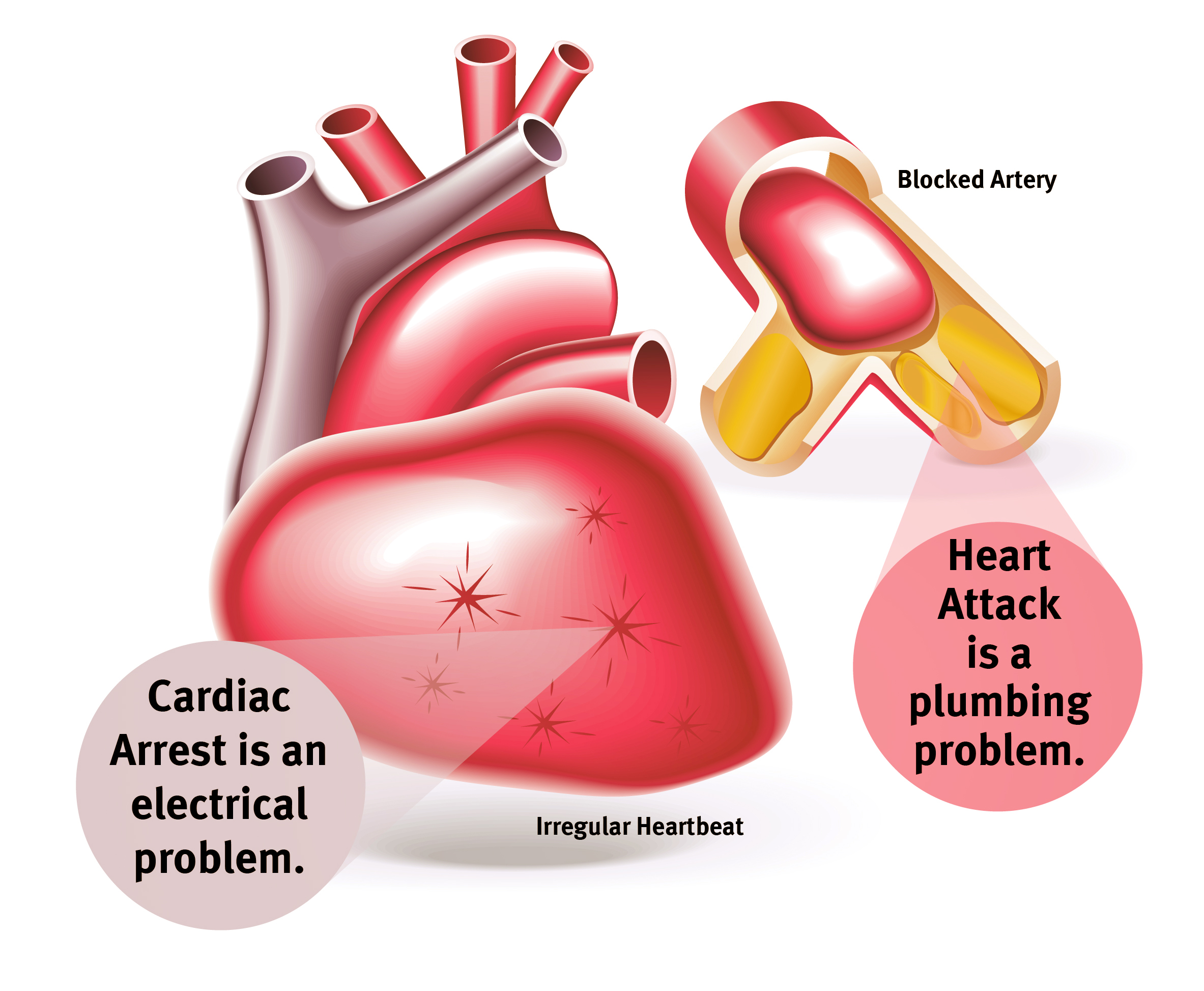 The Difference Between Heart Attack and Cardiac Arrest | Luminis Health