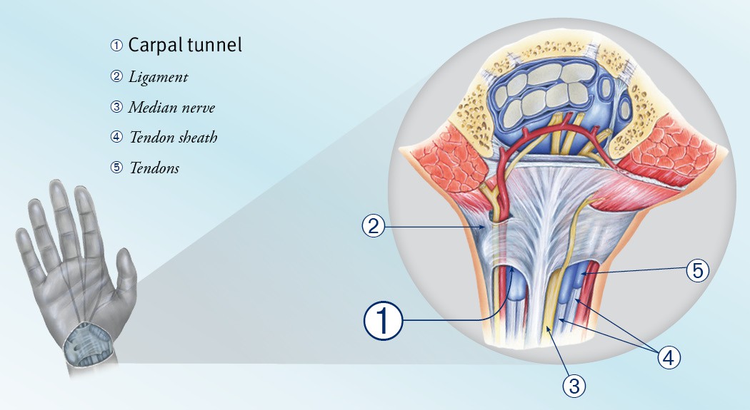 Carpal Tunnel Syndrome in Mesa, Chandler, Gilbert, Tempe, and Phoenix